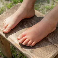 Spuchnięte stopy po cesarce, jedna noga wyraźnie większa od drugiej.