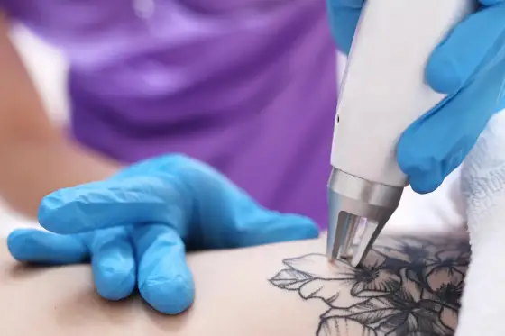 Tatuaż na bliźnie po CC: Przewodnik, bezpieczeństwo i inspiracje
